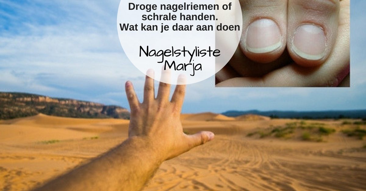 Droge nagelriemen of schrale handen wat kan je er aan doen. Handen die erg droog zijn